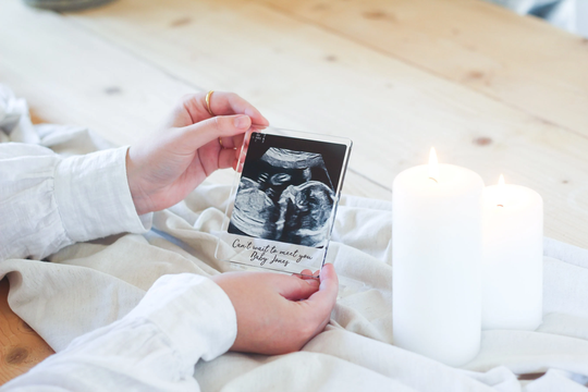 Acrylic Printed Photo With Magnet, Magnet Custom, Personalised Magnets, Gifts, Prints, On